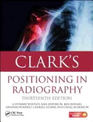 Image of clarks positioning in radiography 13th edition