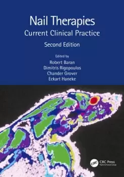 Image of Nail TherapiesCurrent Clinical Practice