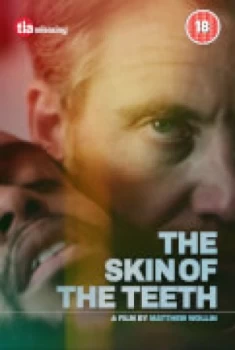 Image of The Skin Of The Teeth