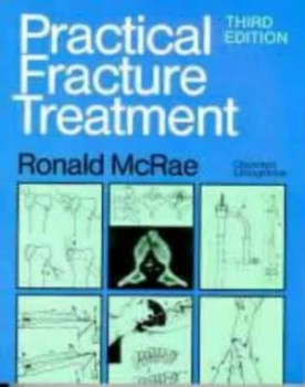 Image of Practical Fracture Treatment by Ronald Mcrae Paperback