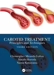 Image of Carotid Treatment: Principles and Techniques