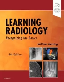 Image of Learning Radiology : Recognizing the Basics