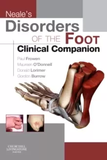 Image of Neale's Disorders of the Foot Clinical Companion