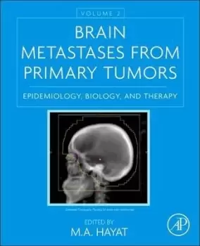 Image of Brain Metastases from Primary Tumors, Volume 2 by M. A. Hayat