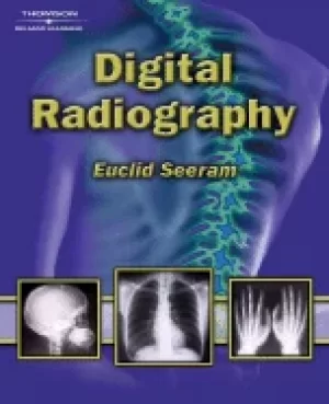 Image of digital radiography an introduction