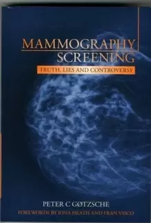 Image of Mammography Screening : Truth, lies and controversy