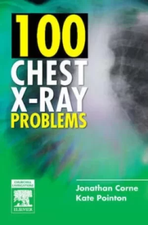 Image of 100 chest X-ray problems by Jonathan Corne