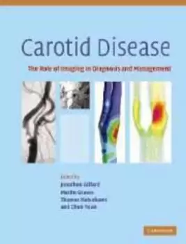 Image of Carotid disease by Jonathan H Gillard