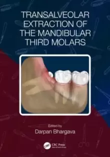 Image of Transalveolar Extraction of the Mandibular Third Molars