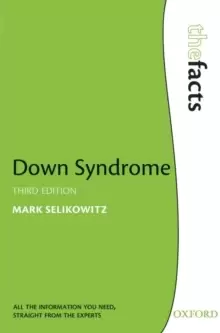 Image of Down Syndrome