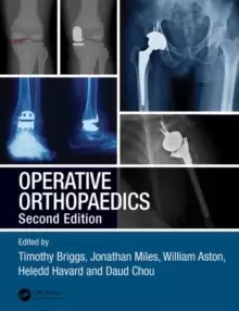 Image of Operative Orthopaedics