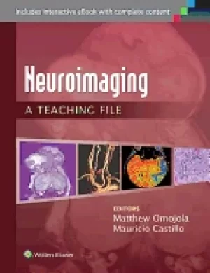 Image of neuroimaging a teaching file a teaching file