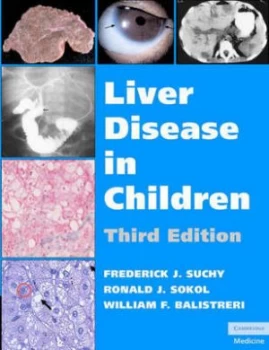Image of Liver Disease in Children by Frederick J. Suchy Hardback