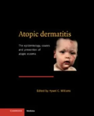 Image of Atopic dermatitis by Hywel C Williams