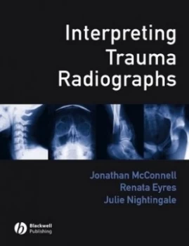 Image of Interpreting Trauma Radiographs by Jonathan Mcconnell Book