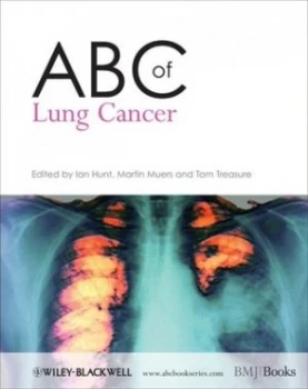 Image of Abc of Lung Cancer by Ian Hunt Paperback